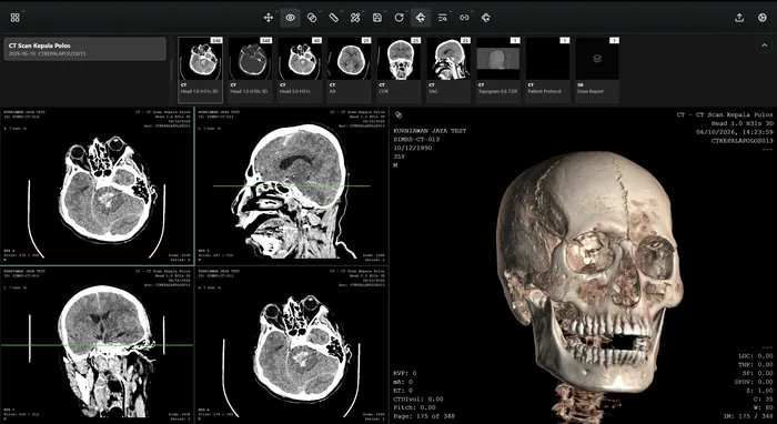 Viewer VEXA PACS dengan viewport rekonstruksi multiplanar dan volume rendering 3D kepala dari pemeriksaan CT.