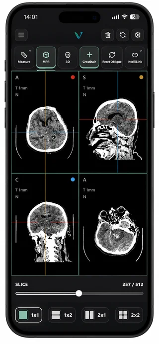 Tata letak mobile VEXA PACS menampilkan studi CT yang sama dalam grid multiplanar 2x2 dengan kontrol slice dan pemilih tata letak.